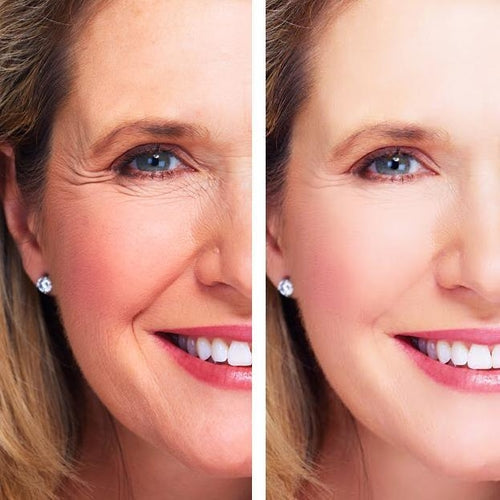 Anti-Aging / Repair